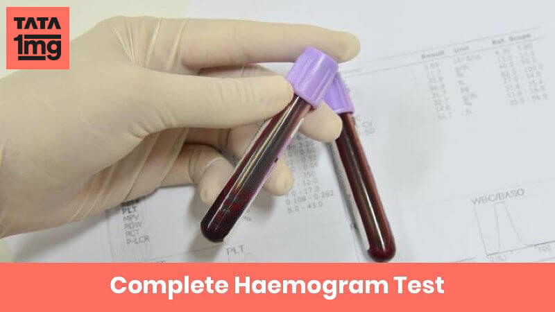 Complete Haemogram